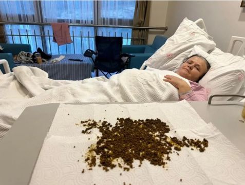 Hastadan çıkan taşları sayamadılar